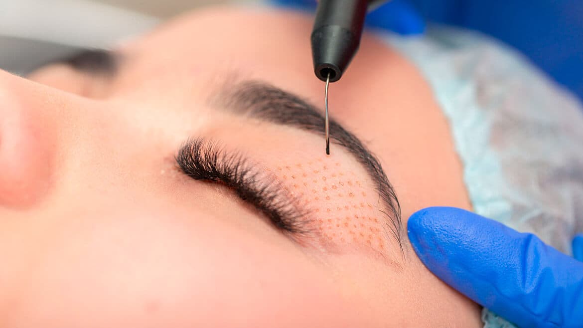 Plasma Pen Technician training at BC Medical Clinic College